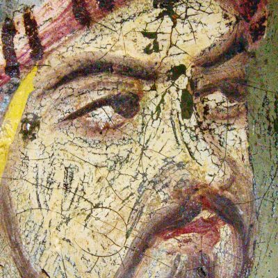 سوراخ ریز روی نگاره و درهم رفتگی لایۀ رنگ روی لباس